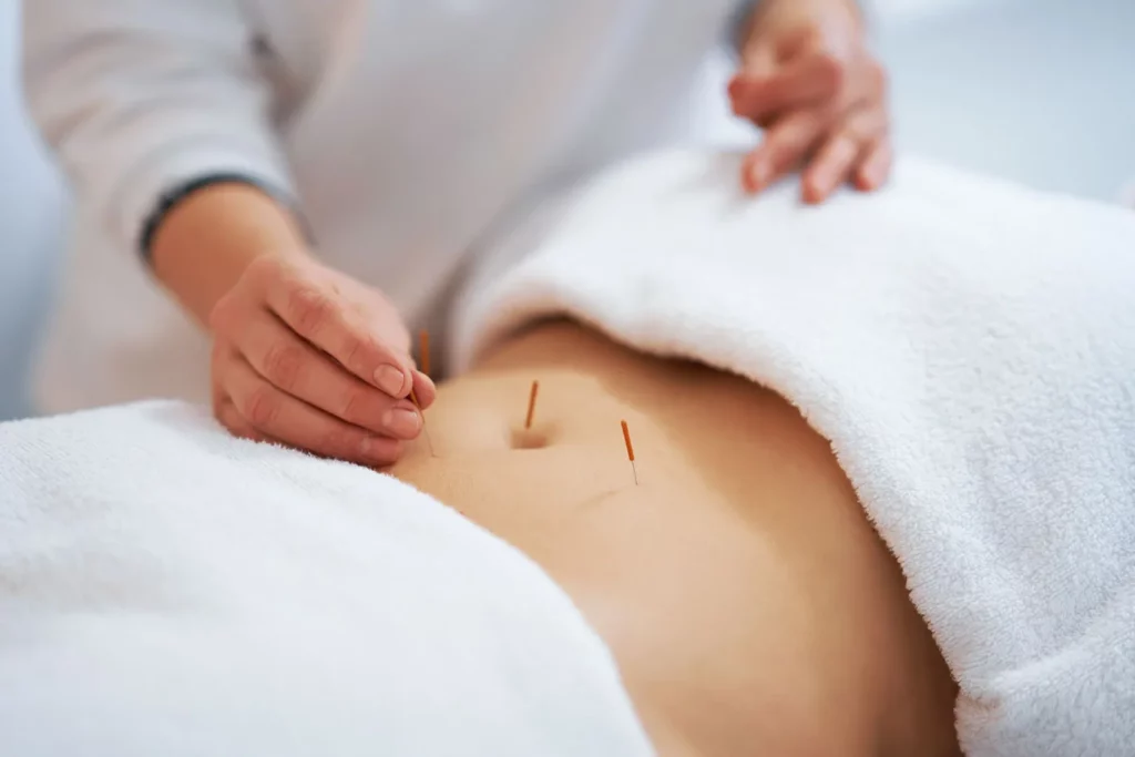 acupuncture stockport