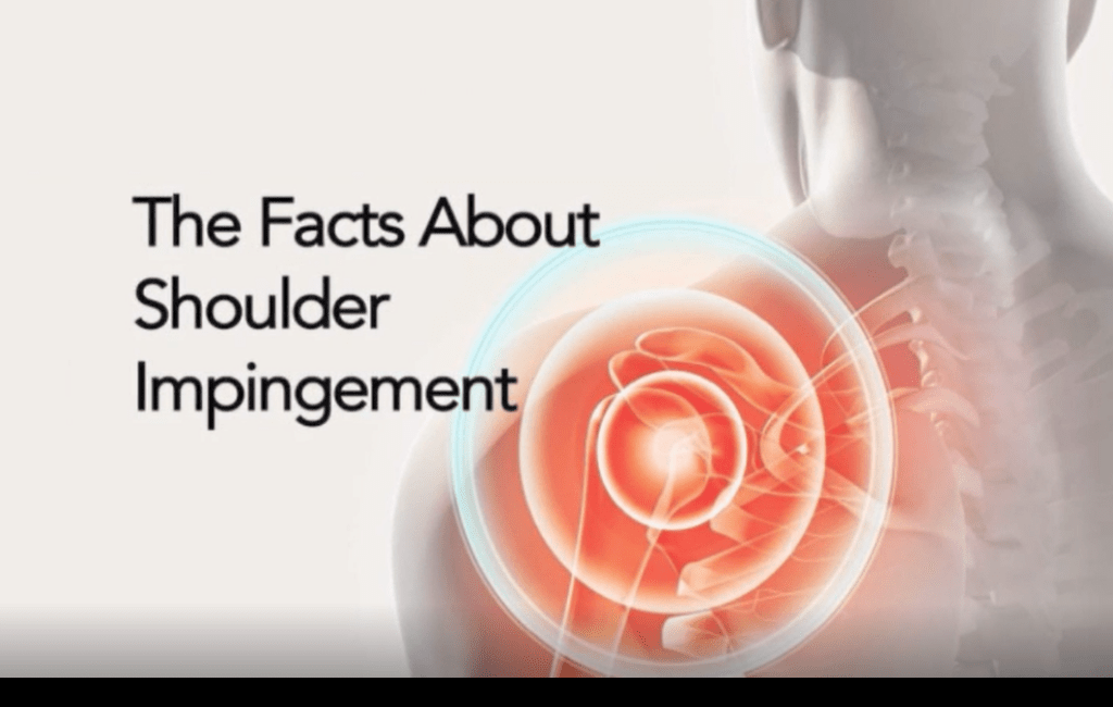 Facts About shoulder impingement photo to go with video 1063x675 1